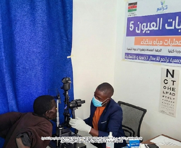 صورة عمليات العيون