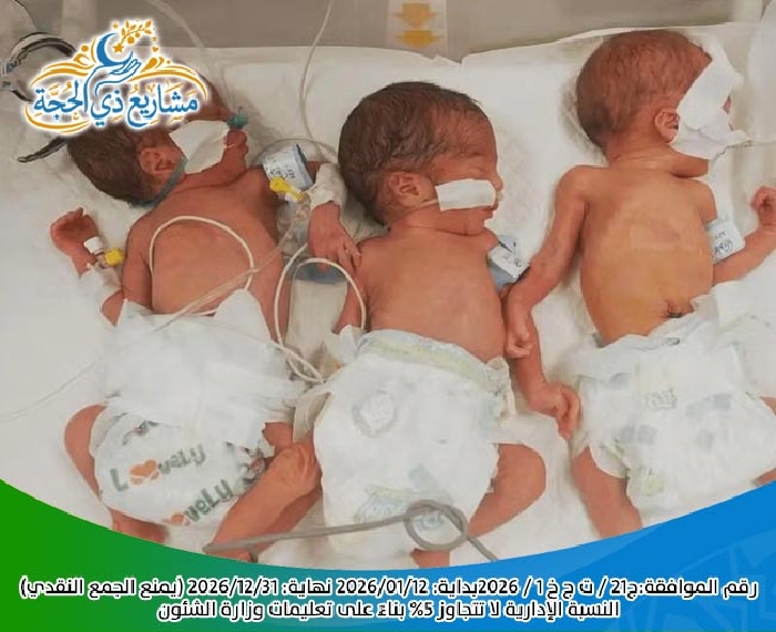 صورة مشروع حليب الاطفال